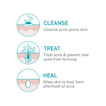 Load image into Gallery viewer, CeraVe Acne Foaming Cream Cleanser 150 ml