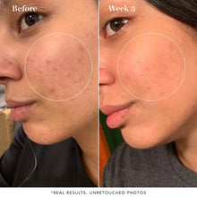 Load image into Gallery viewer, Saturday Skin Pore Clarifying Toner 10% Glycolic Acid + Pore Control Complex
