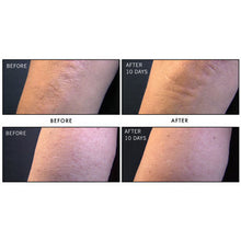 Load image into Gallery viewer, First Aid Beauty KP Bump Eraser Body Scrub with 10% AHA 226 g
