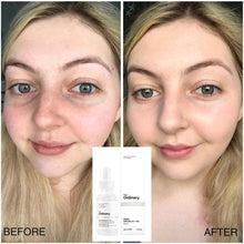 Load image into Gallery viewer, The Ordinary Alpha Arbutin 2% + HA Serum 30ml
