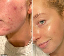 Load image into Gallery viewer, Paula&#39;s Choice Skin Perfecting 2% BHA Liquid Exfoliant
