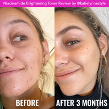Load image into Gallery viewer, Good Molecules Niacinamide Brightening Toner 120ml
