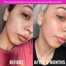 Load image into Gallery viewer, Good Molecules Niacinamide Brightening Toner 120ml
