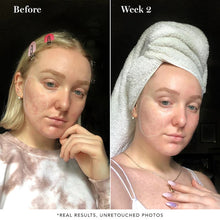 Load image into Gallery viewer, Saturday Skin Pore Clarifying Toner 10% Glycolic Acid + Pore Control Complex
